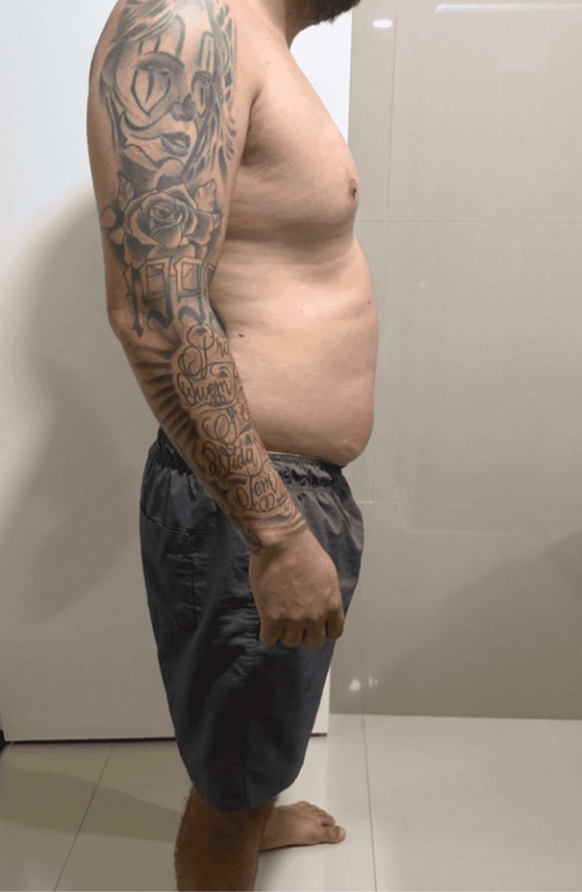 antes e depois 04